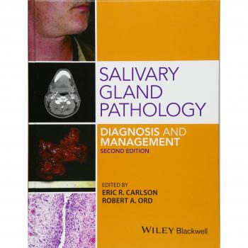 Salivary gland pathology diagnosis and management