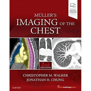 Muller's Imaging of the Chest: Expert Radiology Series, 2e