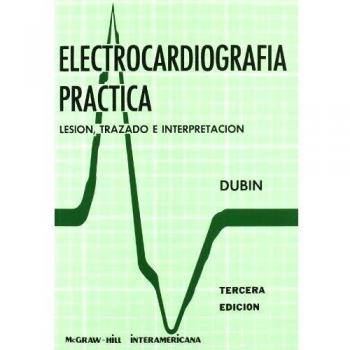 Electrocardiografía práctica