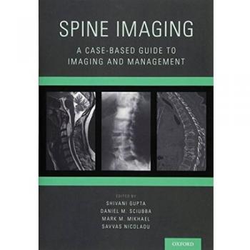 Spine Imaging: A Case-Based Guide to Imaging and Management