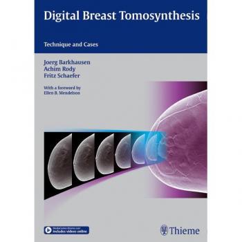 Tomosíntesis Digital de Mama: Técnica y Casos