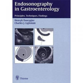 Endosonography in Gastroenterology: Principles, Techniques, Findings