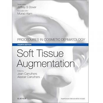 Soft Tissue Augmentation: Procedures in Cosmetic Dermatology Series, 4e
