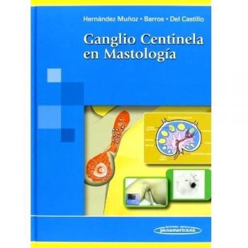 Ganglio centinela en Mastología