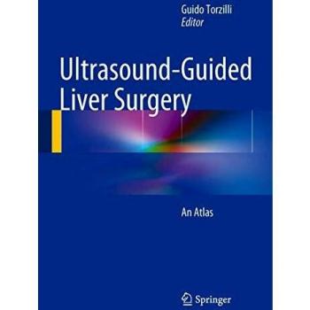 Atlas of Ultrasound-Guided Liver Surgery