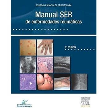 Manual SER de enfermedades reumáticas, 1e