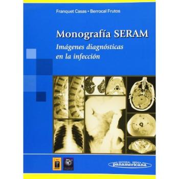Monografía SERAM: Imágenes diagnósticas en la infección