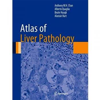 Atlas of Liver Pathology