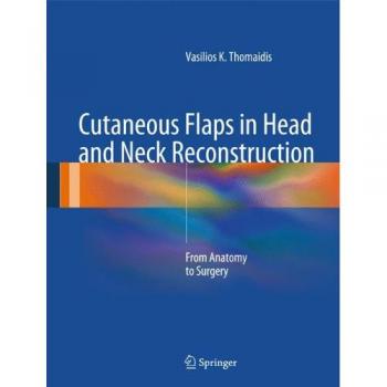 Springer Skin Flaps for Head and Neck Reconstruction