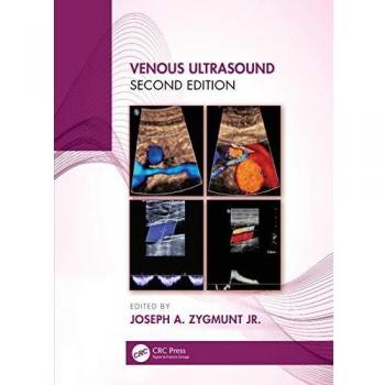 Venous Ultrasound
