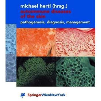 Autoimmune Diseases of the Skin: Pathogenesis, Diagnosis, Management