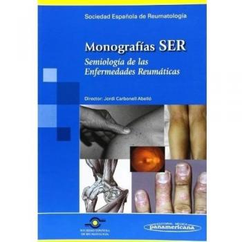 Monografias ser