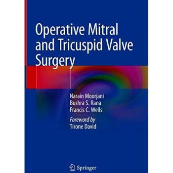 Operative Mitral and Tricuspid Valve Surgery