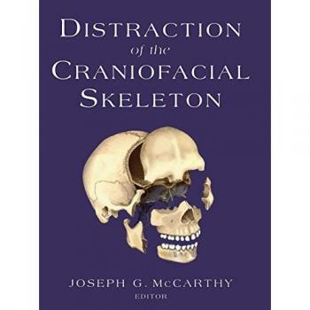 Craniofacial Distraction Device for Solid Tumor Oncology
