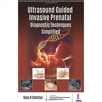 Ultrasound Guided Invasive Prenatal Diagnostic Techniques Simplified