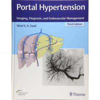 Portal Hypertension: Imaging, Diagnosis, and Endovascular Management