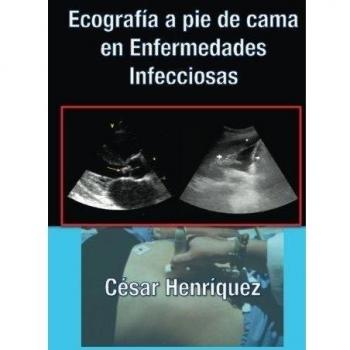 Ecografia a pie de cama en enfermedades infecciosas