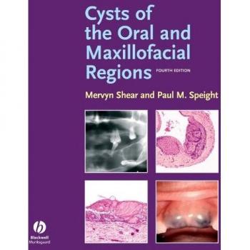 Cysts of the Oral and Maxillofacial Regions