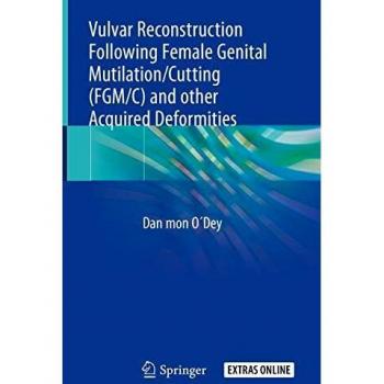 Vulvar Reconstruction Following Female Genital Mutilation/Cutting