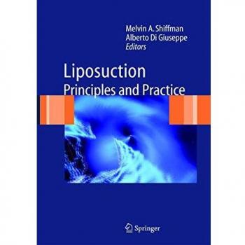 Liposuction: Principles and Practice