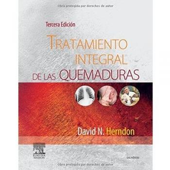 Tratamiento integral de las quemaduras