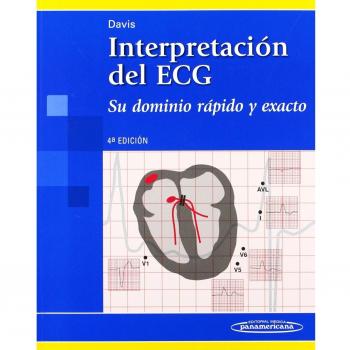 Interpretacion del ECG