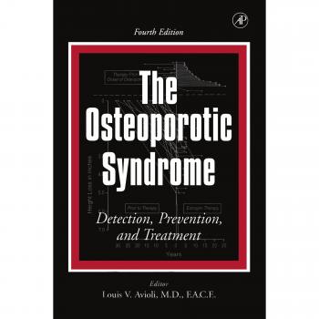 Osteoporotic Syndrome Comprehensive Guide