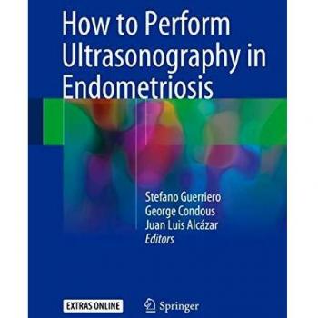 How to Perform Ultrasonography in Endometriosis
