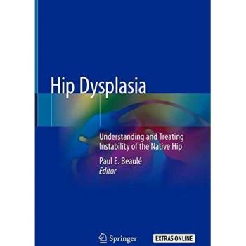 Hip Dysplasia: Understanding and Treating Instability of the Native Hip