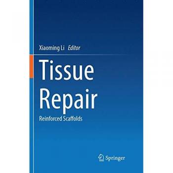 Tissue Repair: Reinforced Scaffolds