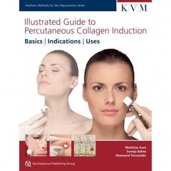 Illustrated Guide to Percutaneous Collagen Induction: Basics, Indications, Uses