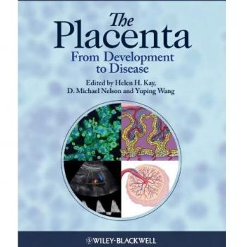 The Placenta: From Development to Disease