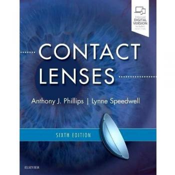 Contact Lenses: Comprehensive Guide, 6th Edition