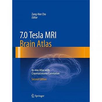 7.0 Tesla MRI Brain Atlas: In-vivo Atlas with Cryomacrotome Correlation
