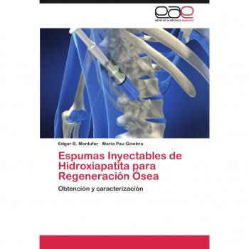 Espumas Inyectables de Hidroxiapatita para Regeneración Ósea: Obtención y caracterización
