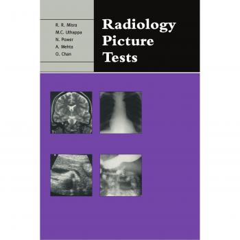 Pruebas de Imágenes en Radiología: Visualización e Interpretación para el Examen Parte 1 FRCR
