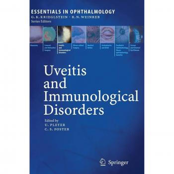 Uveitis and Immunological Disorders: Essentials in Ophthalmology Guide