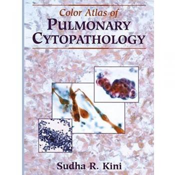 Color Atlas of Pulmonary Cytopathology