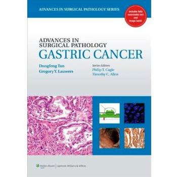 Advances in Surgical Pathology: Gastric Cancer