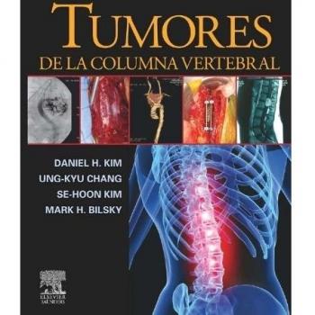 Tumores de la columna vertebral