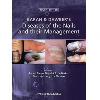 Baran and Dawber′s Diseases of the Nails and their Management