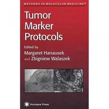 Tumor Marker Protocols: 14