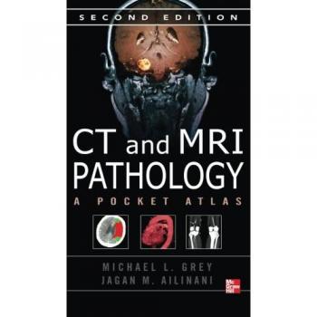 Ct & Mri Pathology: A Pocket Atlas, Second Edition