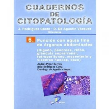Punción con aguja fina de órganos abdominales: Cuadernos de citopatología-6