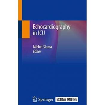 Echocardiography in ICU