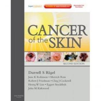 Cancer of the Skin: Expert Consult - Online and Print, 2e