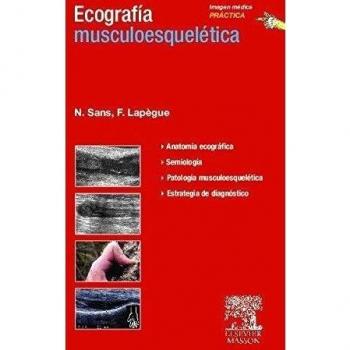Ecografía musculoesquelética