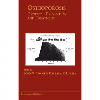 Osteoporosis Insights: Genetics, Prevention & Treatment Guide