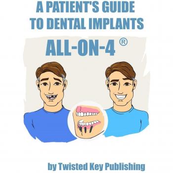 Guía del Paciente sobre Implantes Dentales: Todo en 4