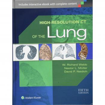High-Resolution CT of the Lung